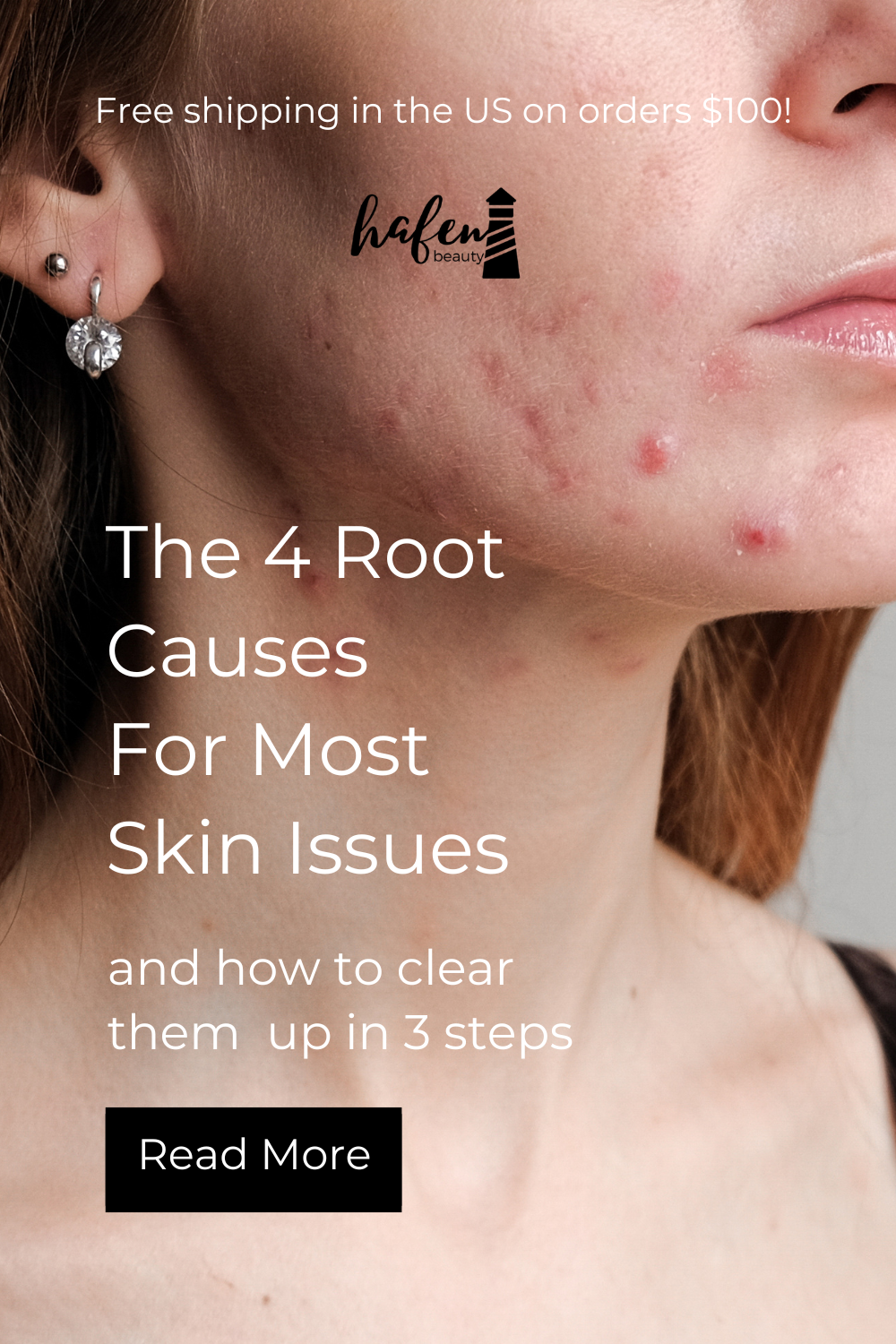 Unveiling the 4 Major Root Causes of Skin Issues and their Symptoms